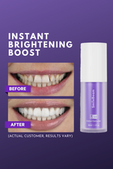 SmileBeamâ„?Colour Corrector Serum